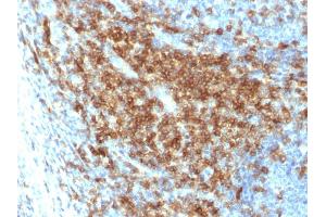 Formalin-fixed, paraffin-embedded human Tonsil stained with CD43 Rabbit Recombinant Monoclonal Antibody (SPN/2049R). (Recombinant CD43 抗体)