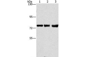 Western Blot analysis of MCF7, hela and 293T cell using GGCX Polyclonal Antibody at dilution of 1:400 (GGCX 抗体)