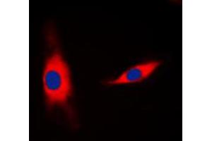 Immunofluorescent analysis of 14-3-3 eta staining in MCF7 cells. (14-3-3 eta 抗体  (Center))