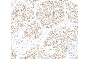 anti-Nucleoprotein TPR (TPR) (C-Term) antibody