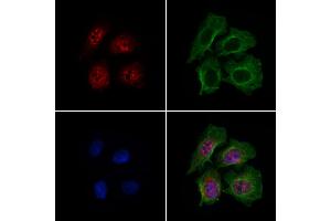 ABIN7094787 and ABIN7098838 staining HepG2 cells by IF/ICC.