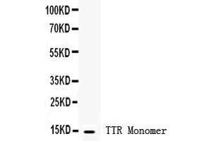 Anti- Prealbumin Picoband antibody, Western blottingAll lanes: Anti Prealbumin  at 0. (TTR 抗体  (AA 21-147))