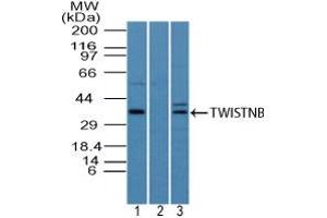Image no. 1 for anti-TWIST Neighbor (TWISTNB) (AA 50-100) antibody (ABIN960391) (TWIST Neighbor 抗体  (AA 50-100))