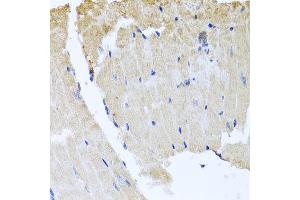 Immunohistochemistry of paraffin-embedded mouse heart using RAB24 antibody at dilution of 1:100 (x40 lens). (RAB24 抗体)