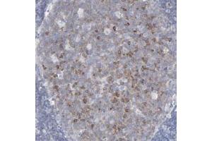 Immunohistochemical staining (Formalin-fixed paraffin-embedded sections) of human lymph node with P2RY8 polyclonal antibody  shows cytoplasmic positivity in reaction center cells at 1:50-1:200 dilution. (P2RY8 抗体)