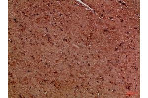 Immunohistochemical analysis of paraffin-embedded Human-brain, antibody was diluted at 1:100 (EYA1 抗体)