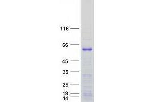 EBF3 Protein (Myc-DYKDDDDK Tag)