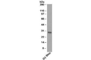Western blot testing of human samples using Bcl-2 antibody (124). (Bcl-2 抗体  (AA 41-54))