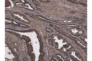 Immunohistochemistry (IHC) image for anti-Numb Homolog (NUMB) (C-Term) antibody (ABIN184679)
