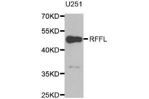 Western blot analysis of extracts of U251 cell line, using RFFL antibody. (RFFL 抗体)