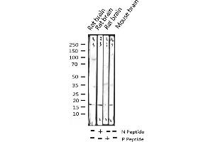 Western blot analysis of Phospho-Histone H3. (Histone H3.1 抗体  (pSer10))