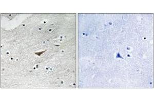 Immunohistochemistry analysis of paraffin-embedded human brain, using VE-Cadherin (Phospho-Tyr731) Antibody. (Cadherin 5 抗体  (pTyr731))