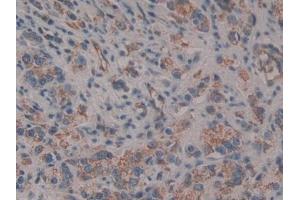 Immunohistochemistry (IHC) image for anti-CD109 (CD109) (AA 1146-1390) antibody (ABIN7440599)