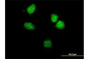 Immunofluorescence of monoclonal antibody to HOXA5 on HeLa cell. (HOXA5 抗体  (AA 171-270))