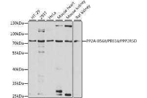 Western blot analysis of extracts of various cell lines, using PP2A-B56δ/PR61δ/PP2A-B56δ/PR61δ/PPP2R5D antibody (ABIN7269690) at 1:1000 dilution. (PPP2R5D 抗体  (AA 450-550))