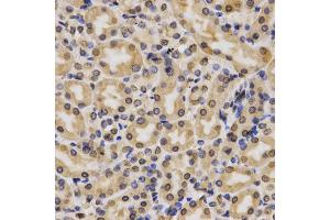 Immunohistochemistry of paraffin-embedded rat kidney using MonoMethyl-Histone H3-K4 antibody (ABIN1872994) at dilution of 1:200 (40x lens). (Histone 3 抗体  (H3K4me))