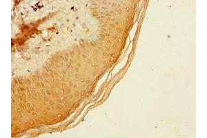 Immunohistochemistry of paraffin-embedded human skin tissue using ABIN7173532 at dilution of 1:100 (ADAT1 抗体  (AA 1-501))
