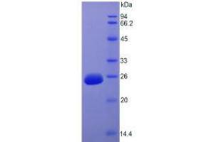 SDS-PAGE analysis of Rat FGF15 Protein. (FGF15 蛋白)