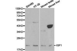 Western Blotting (WB) image for anti-Insulin-Like Growth Factor 1 (IGF1) antibody (ABIN1873156) (IGF1 抗体)