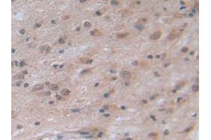 Immunohistochemistry (IHC) image for anti-Notch 4 (NOTCH4) (AA 1715-2001) antibody (ABIN7442495)