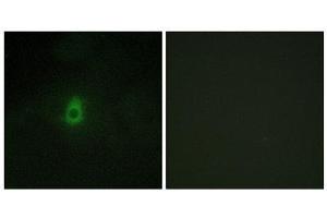 Immunofluorescence (IF) image for anti-Cytochrome P450, Family 2, Subfamily E, Polypeptide 1 (CYP2E1) (C-Term) antibody (ABIN1850358) (CYP2E1 抗体  (C-Term))