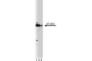 Western blot analysis of TLS on a Jurkat cell lysate. (FUS 抗体  (AA 2-117))