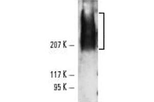 Western blot analysis of TRA-1-81 expression using TRA-1-81 monoclonal antibody, clone TRA-1-81  in NTERA-2 cl. (TRA1-81 抗体)