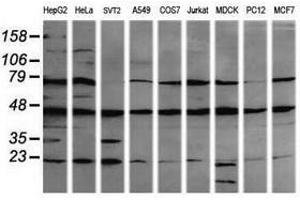 Image no. 1 for anti-Mitogen-Activated Protein Kinase Kinase 1 (MAP2K1) antibody (ABIN1499374) (MEK1 抗体)