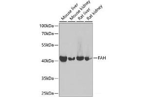 Western blot analysis of extracts of various cell lines using FAH Polyclonal Antibody at dilution of 1:1000. (FAH 抗体)
