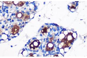 Immunohistochemistry of paraffin-embedded Rat fat using UCP1 Polyclonal Antibody at dilution of 1:100 (40x lens). (UCP1 抗体)