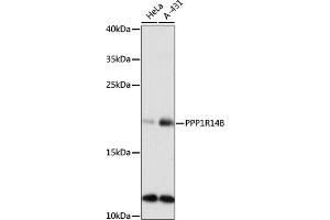 Western blot analysis of extracts of various cell lines, using PPP1R14B antibody (ABIN7269675) at 1:1000 dilution. (PPP1R14B 抗体  (AA 68-147))