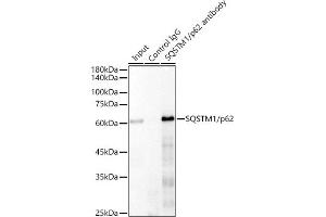 Immunoprecipitation analysis of 300 μg extracts of 293T cells using 3 μg SQSTM1/p62 antibody (ABIN7270205). (SQSTM1 抗体)