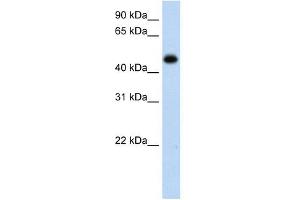 HAO1 antibody used at 1 ug/ml to detect target protein. (HAO1 抗体)
