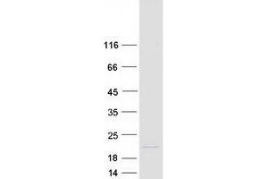 Validation with Western Blot
