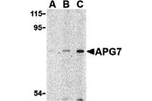 Western Blotting (WB) image for anti-ATG7 Autophagy Related 7 (ATG7) (N-Term) antibody (ABIN1031233) (ATG7 抗体  (N-Term))
