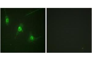Immunofluorescence analysis of NIH-3T3 cells, using MSK1 (Phospho-Ser360) Antibody. (MSK1 抗体  (pSer360))