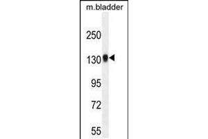Western blot analysis in mouse bladder tissue lysates (35ug/lane). (TDRD7 抗体  (C-Term))