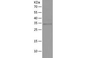 Western Blotting (WB) image for Uridine Phosphorylase 1 (UPP1) (AA 1-310) protein (His tag) (ABIN7287384) (UPP1 Protein (AA 1-310) (His tag))