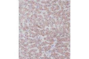 Immunohistochemical analysis of C on paraffin-embedded Human liver tissue. (UGT2B15 抗体  (AA 156-185))