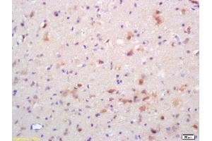 Formalin-fixed and paraffin embedded rat brain labeled with Rabbit Anti Phospho-NMDAR2B (Tyr1336) Polyclonal Antibody, Unconjugated (ABIN801228) at 1:200 followed by conjugation to the secondary antibody and DAB staining (GRIN2B 抗体  (pTyr1336))