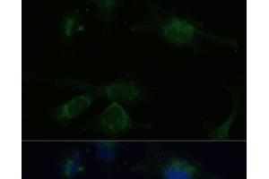 Immunofluorescence analysis of U-251 MG cells using VHL Polyclonal Antibody at dilution of 1:100 (40x lens). (VHL 抗体)