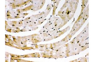 Anti- SIRT6Picoband antibody, IHC(P) IHC(P): Mouse Cardiac Muscle Tissue (SIRT6 抗体  (AA 14-180))