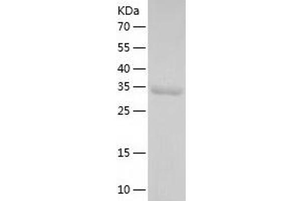 IMPAD1 Protein (AA 34-359) (His tag)
