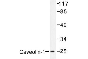 Image no. 1 for anti-Caveolin 1, Caveolae Protein, 22kDa (CAV1) antibody (ABIN265339) (Caveolin-1 抗体)