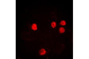 Immunofluorescent analysis of Histone H2B (AcK12) staining in HeLa cells. (Histone H2B 抗体  (acLys12, N-Term))
