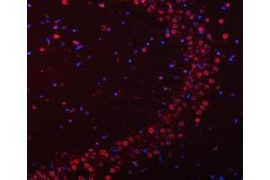 IF analysis of SNRPN using anti-SNRPN antibody (ABIN3043934).