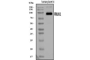 Western blot analysis of Fibulin 1/FBLN1 using anti-Fibulin 1/FBLN1 antibody (ABIN7601231).