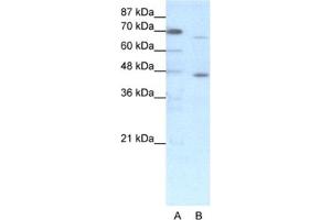 Western Blotting (WB) image for anti-Estrogen Receptor 2 (ESR2) antibody (ABIN2460264) (ESR2 抗体)