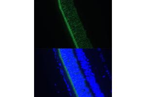 Immunofluorescence analysis of rat eye using GNGT1 Polyclonal Antibody (ABIN7267288) at dilution of 1:100 (40x lens). (GNGT1 抗体  (AA 1-45))