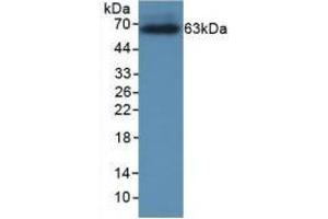 Western Blotting (WB) image for anti-Corticotropin Releasing Hormone Binding Protein (CRHBP) (AA 25-322) antibody (ABIN7427561)